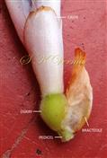 Young flower-see calyx,  ovary and Bracteole